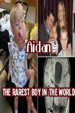 Watch Aidan The Rarest Boy In The World 123MoviesFree