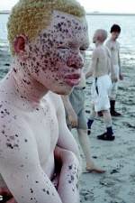 Watch Albino United 123MoviesFree