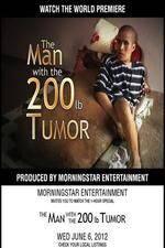 Watch The Man With The 200lb Tumor 123MoviesFree