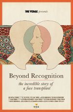 Watch Beyond Recognition: The Incredible Story of a Face Transplant 123MoviesFree
