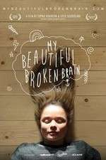 Watch My Beautiful Broken Brain 123MoviesFree