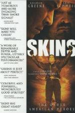 Watch Skins 123MoviesFree