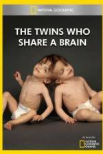 Watch National Geographic The Twins Who Share A Brain 123MoviesFree