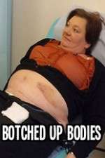 Watch Botched Up Bodies 123MoviesFree