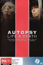 Watch Autopsy: Life and Death 123MoviesFree